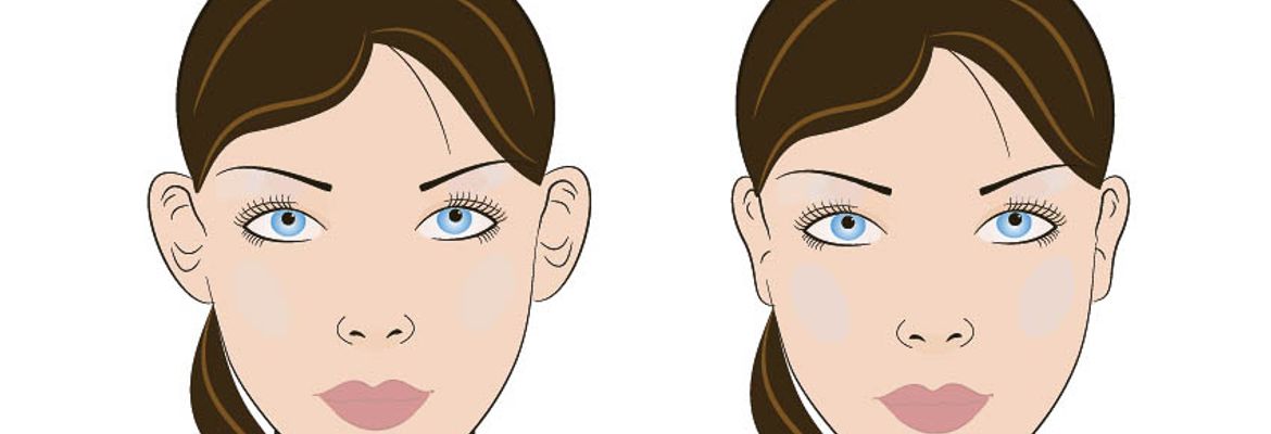 otoplasty faces procedure in costa rica